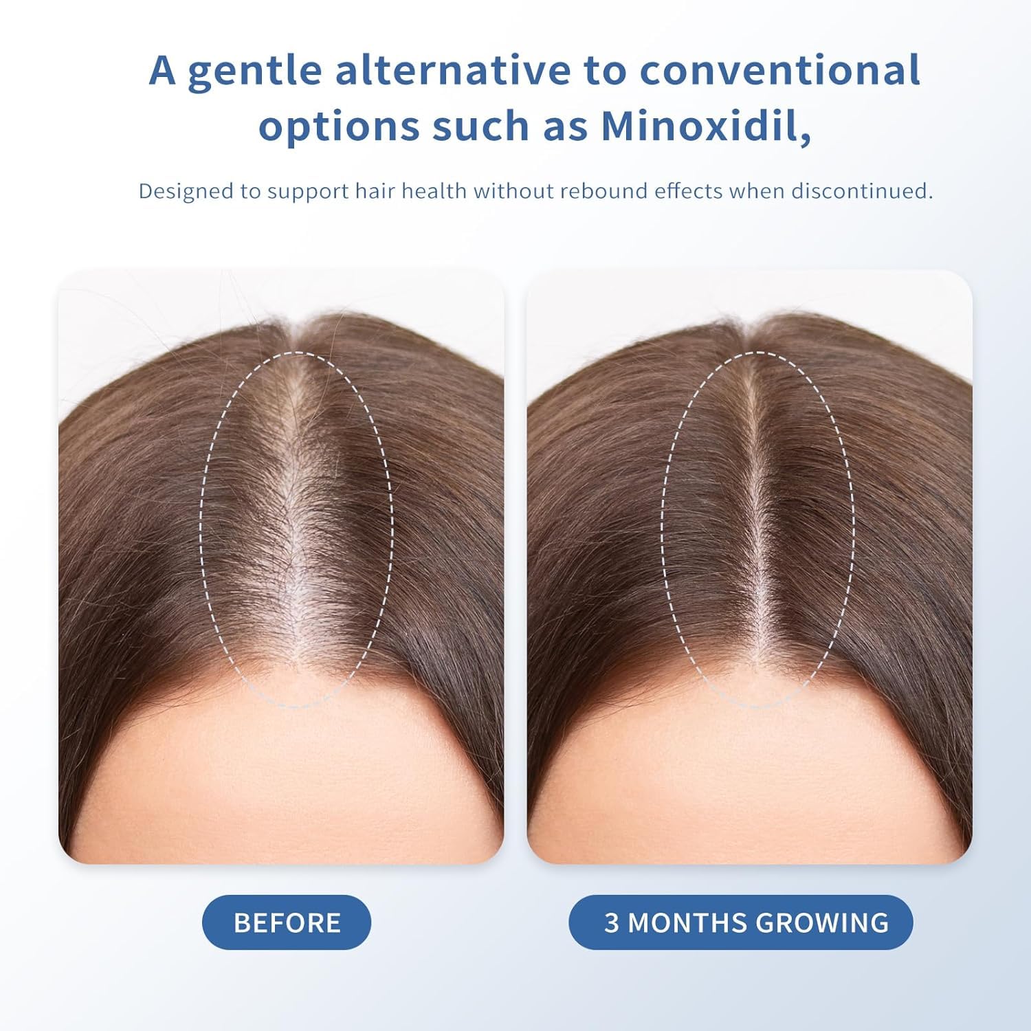 Singrace Serum absorbs quickly without greasiness on the scalp.