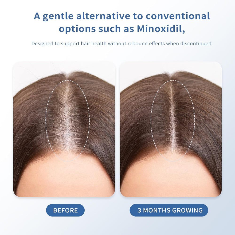 Singrace Serum absorbs quickly without greasiness on the scalp.
