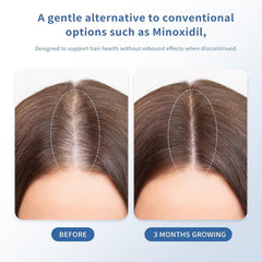 Singrace Serum absorbs quickly without greasiness on the scalp.