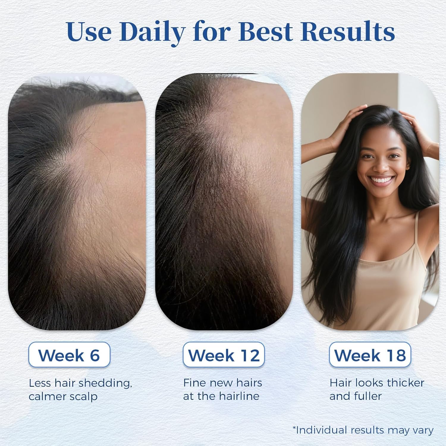 Singrace Hair Growth Serum texture illustrates no rinse and light feel.