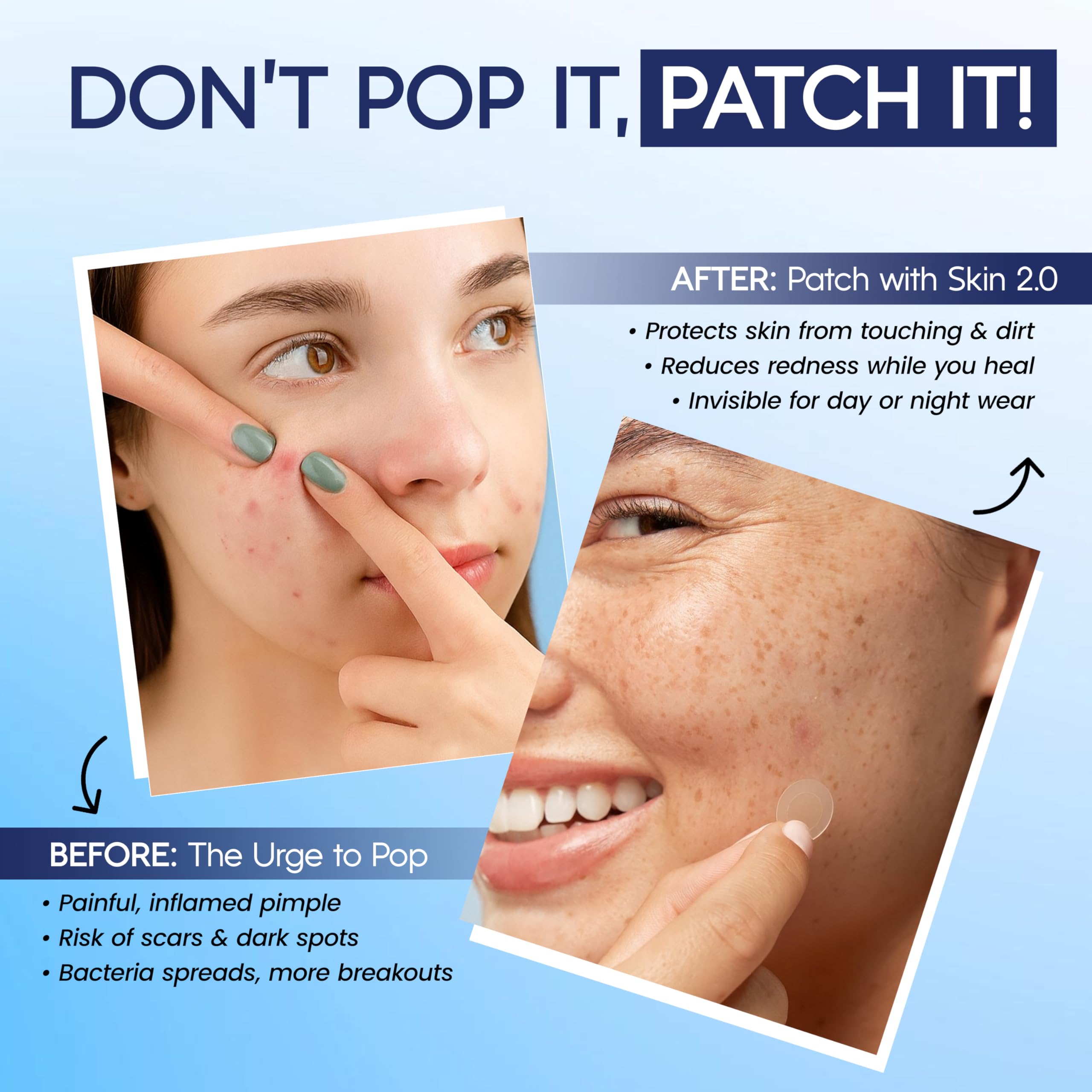 Skin 2.0 dermatologist-tested vegan patch ensures safe, clean skincare.