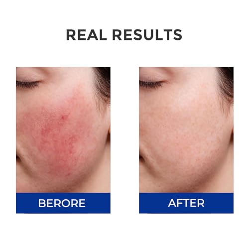 Licorice extract close-up signals soothing properties for redness support.