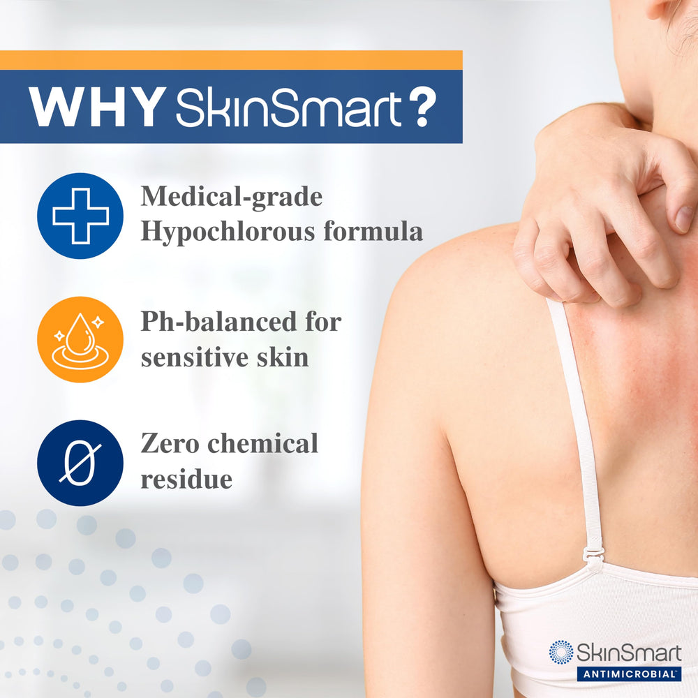 SkinSmart eczema spray being applied to hand to support daily barrier care.