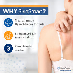 SkinSmart eczema spray being applied to hand to support daily barrier care.