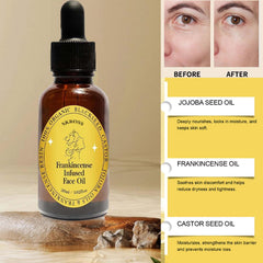SKROSS Frankincense Resin Oil label emphasizes natural ingredients.