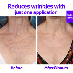 Skywee décolleté pad from the two-piece set for targeted coverage