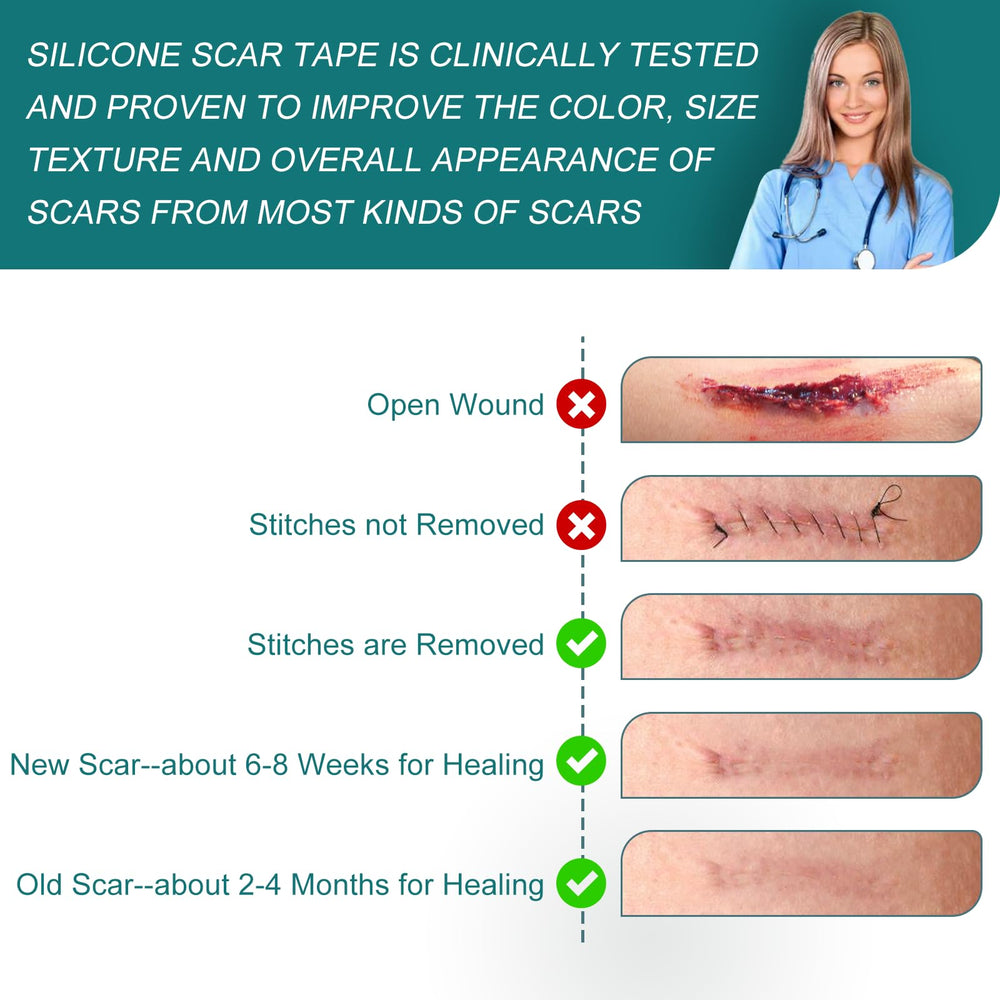 SLUKHIG silicone-scar-tape-protection-friction guards scars from irritation.