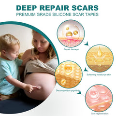 SLUKHIG silicone scar sheets invisible-application shows clear scar coverage on skin.