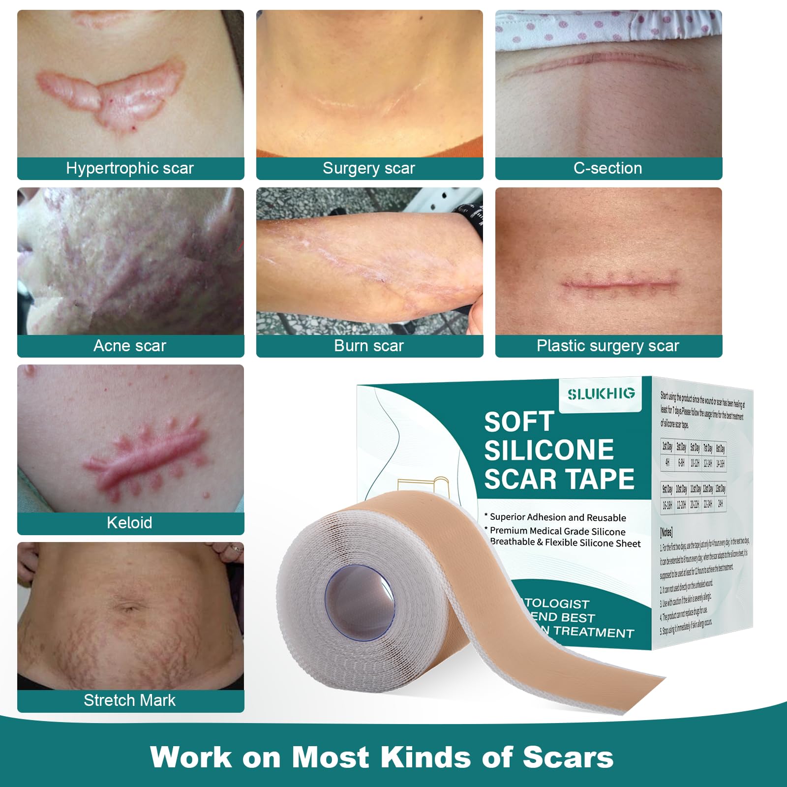 SLUKHIG silicone scar sheets packaging shows reusable scar tape for ongoing care
