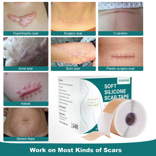 SLUKHIG silicone scar-tape-application-closeup demonstrates gentle adhesion suitable for daily wear.