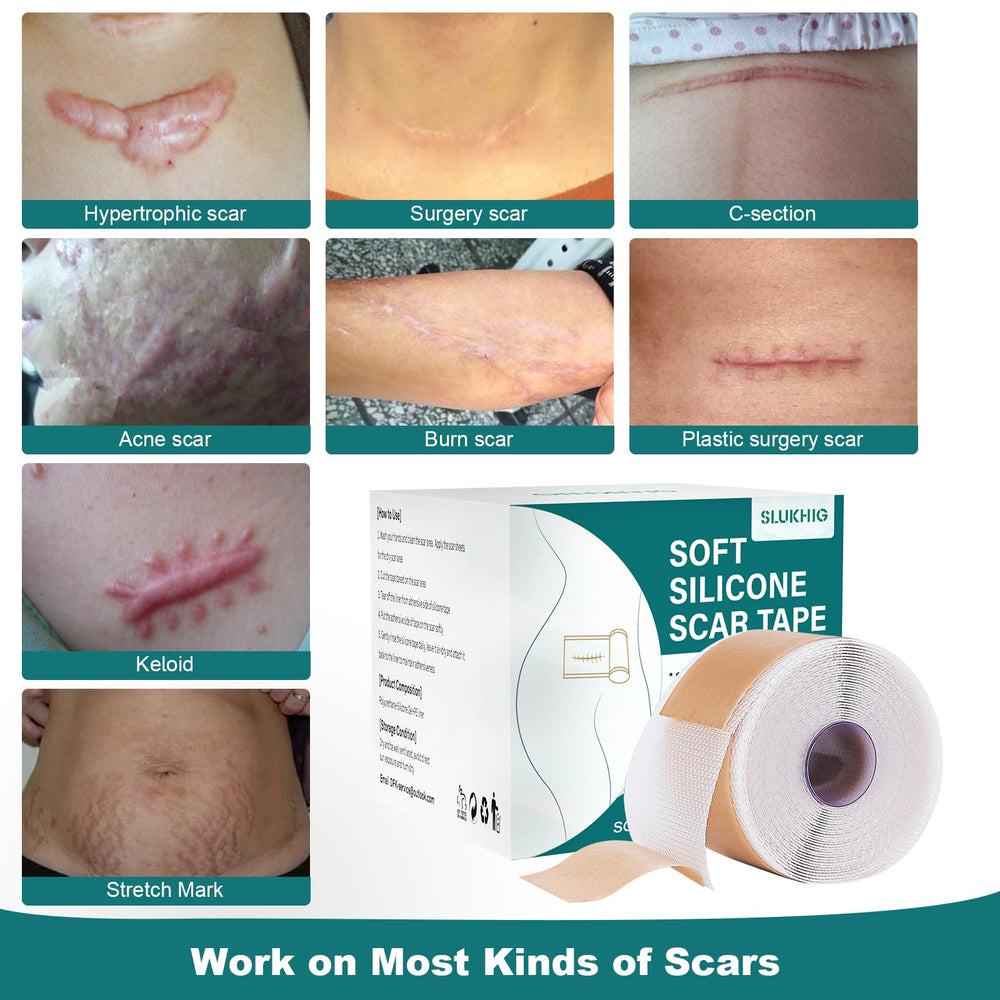 SLUKHIG silicone scar-tape-application-closeup demonstrates gentle adhesion suitable for daily wear.
