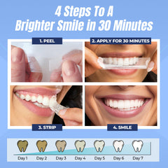 Before and after smile using Smilegasm whitening strips