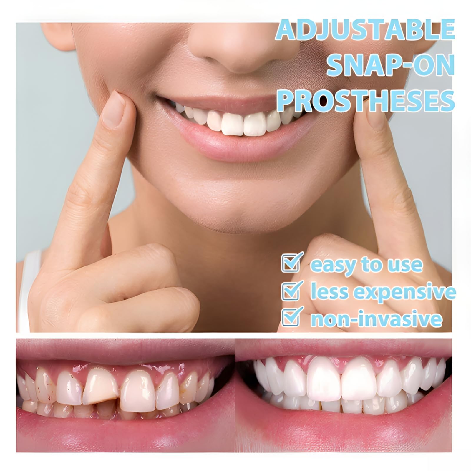 Close-up of smile set aligning with teeth