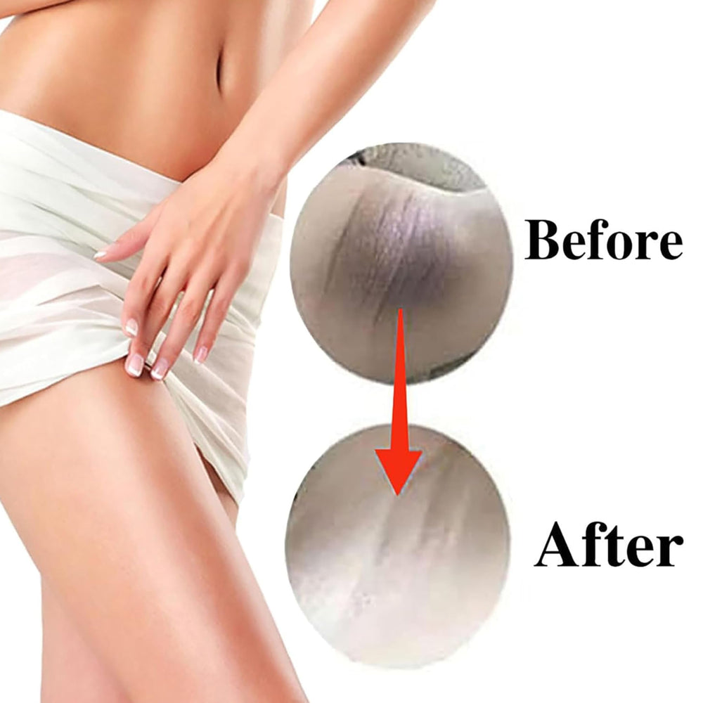 SMILEFACE bikini-area cream demonstrating discreet application and even tone