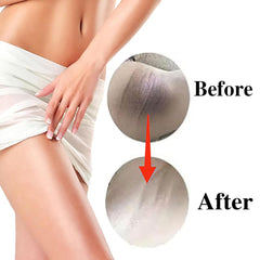 SMILEFACE bikini-area cream demonstrating discreet application and even tone