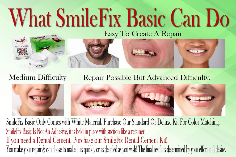 SmileFix Basic kit contents laid out