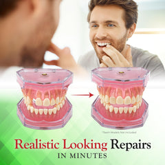 Thermoplastic beads for SmileFix Basic