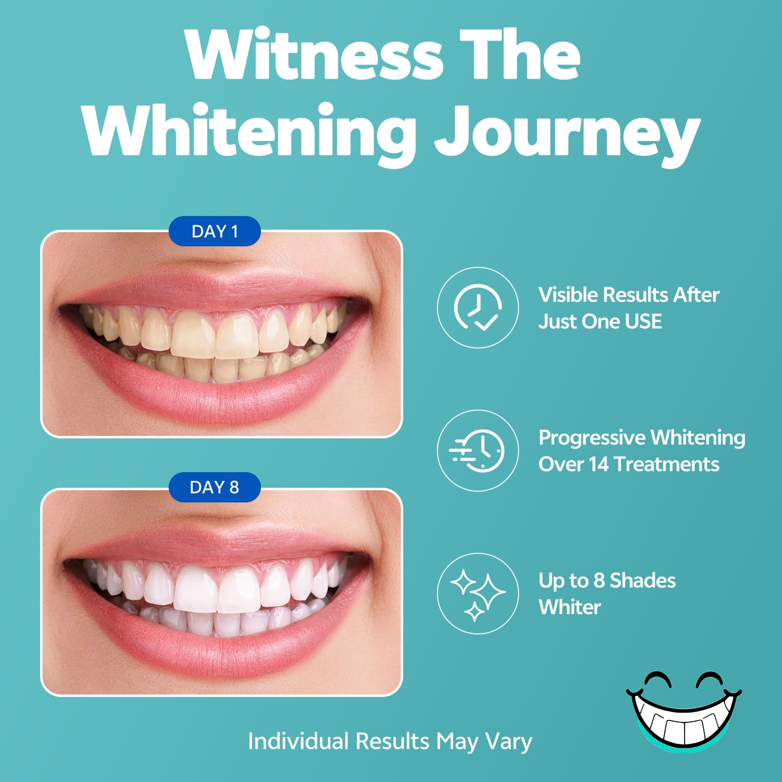 Whitening strips for upper and lower teeth during 14-day treatment