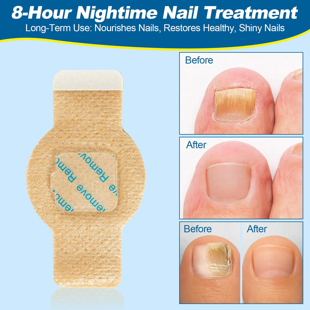 Snifflink night-use patch applied on nail for overnight renewal routine.
