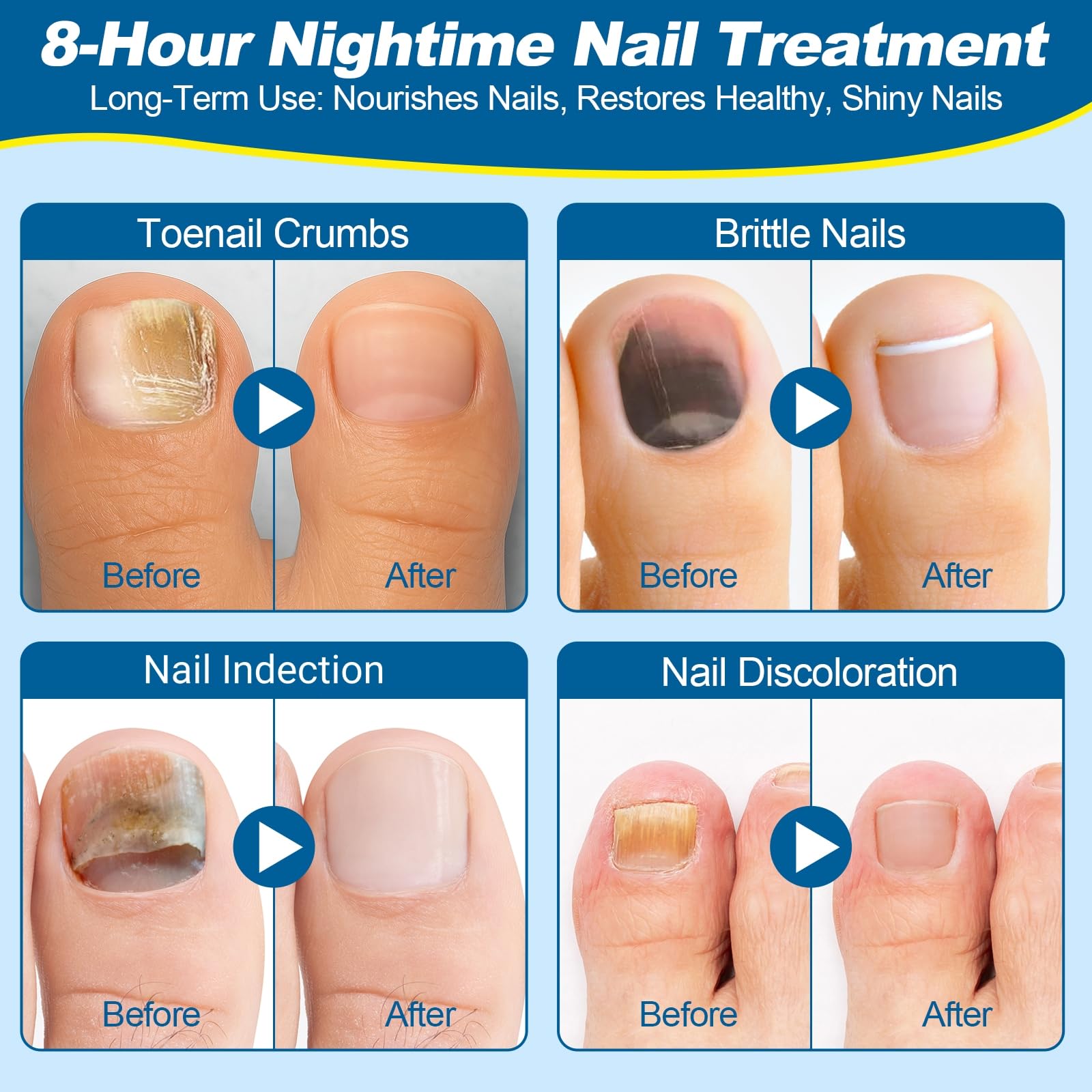 Snifflink tear-and-stick toe patches in use for easy application.