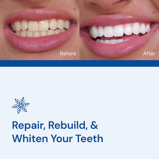 Snow Diamond LED mouthpiece with whitening serum