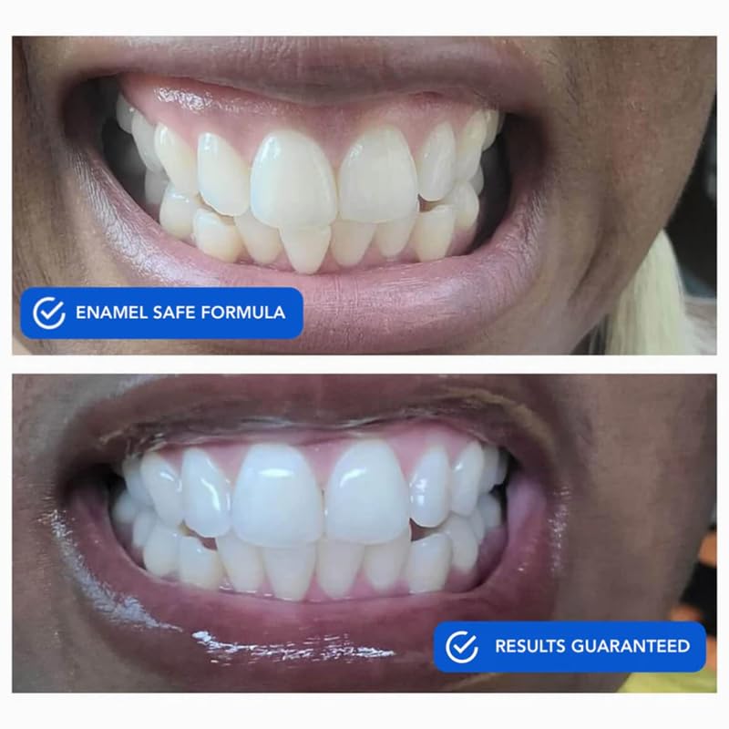 Close-up of a dissolvable whitening strip