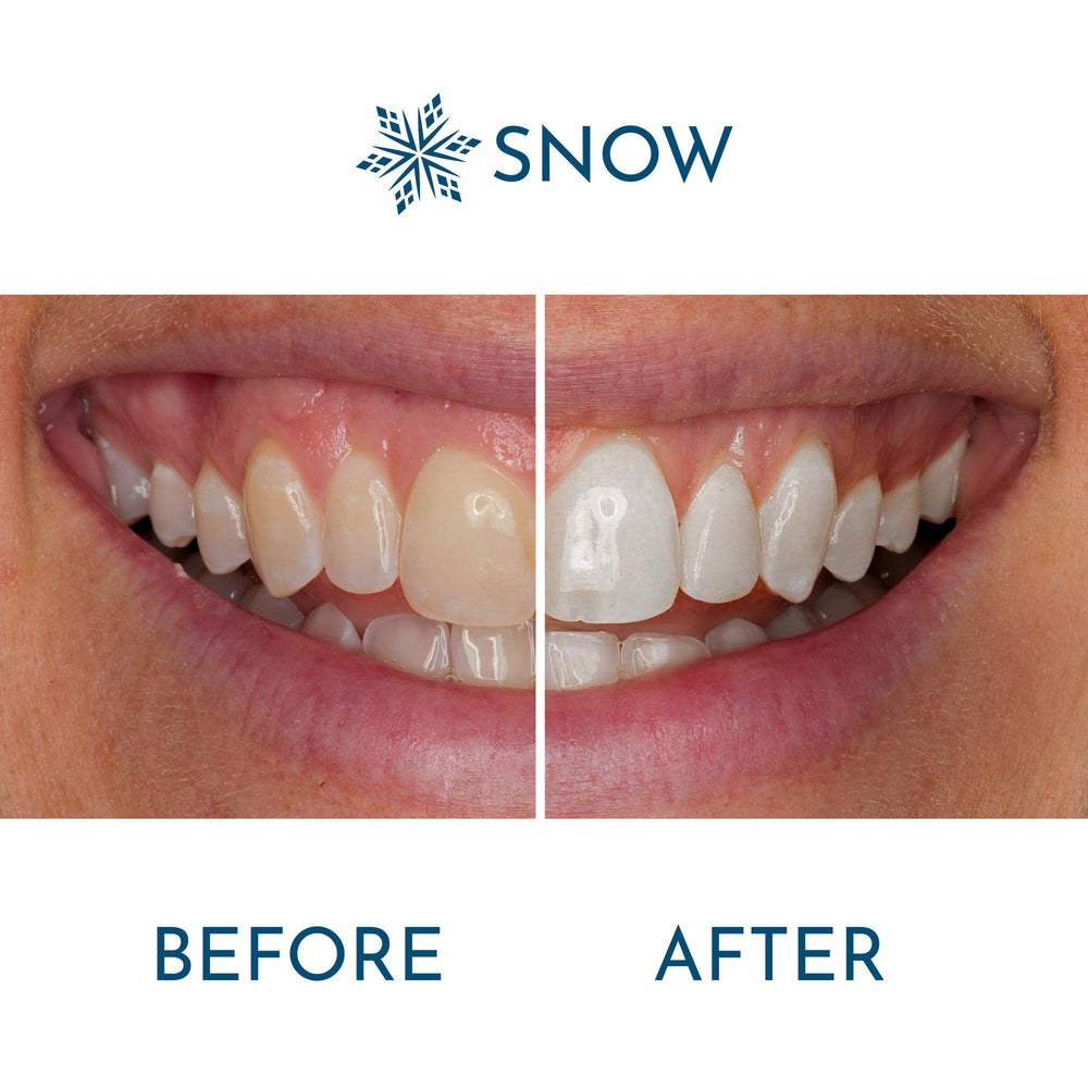 Snow logo with enamel-safe whitening products