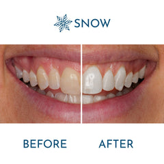 Snow logo with enamel-safe whitening products