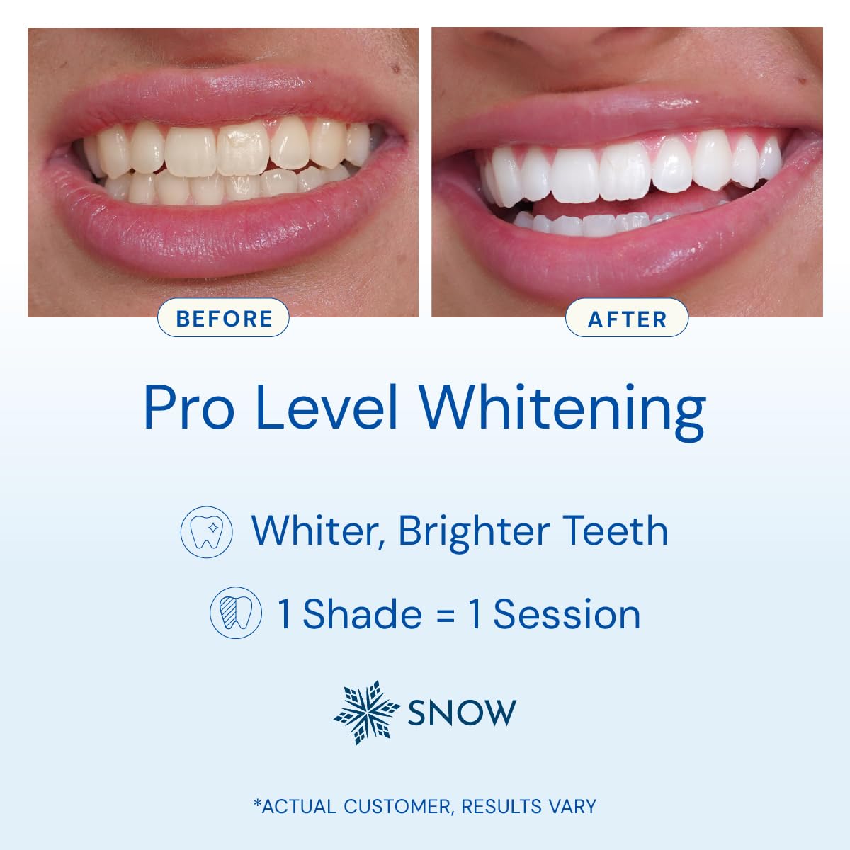 Close-up of wand applying whitening serum