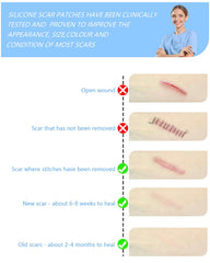 Somlzu scar tape appears nearly invisible when applied to skin for discreet wear.