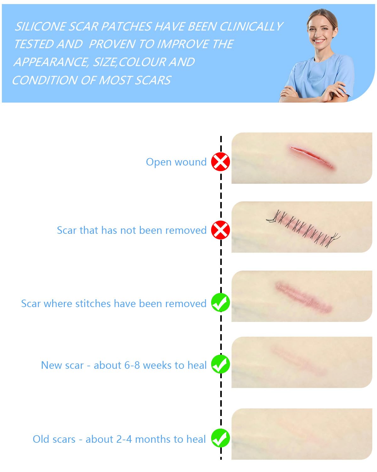 Somlzu silicone scar sheets moisture environment supports scar management