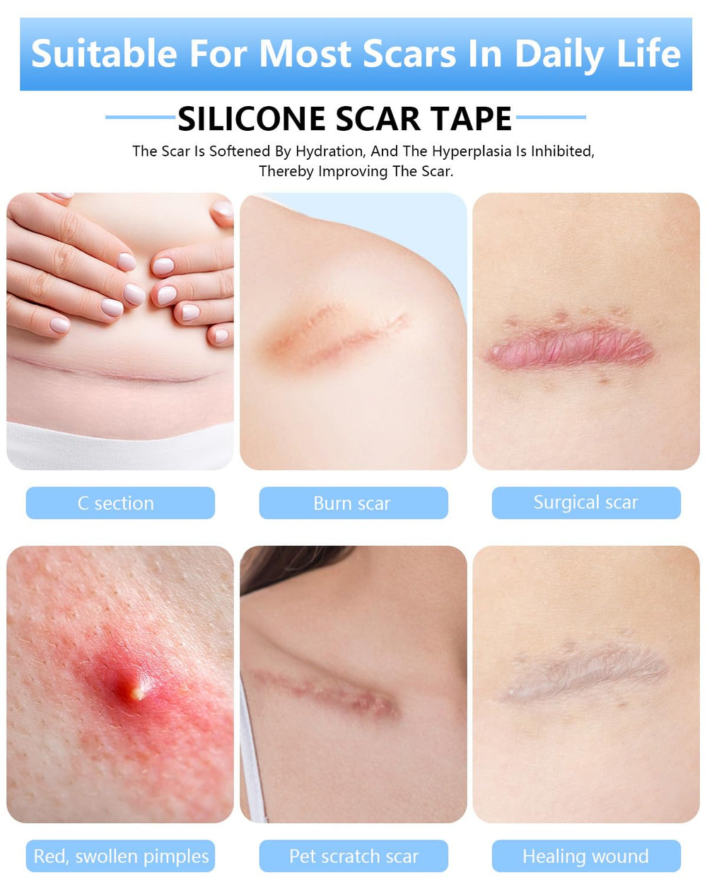 Somlzu silicone scar sheets soft texture hugs body contours