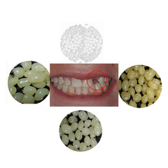 Sowsmile 4-color temporary teeth repair beads kit showing color options
