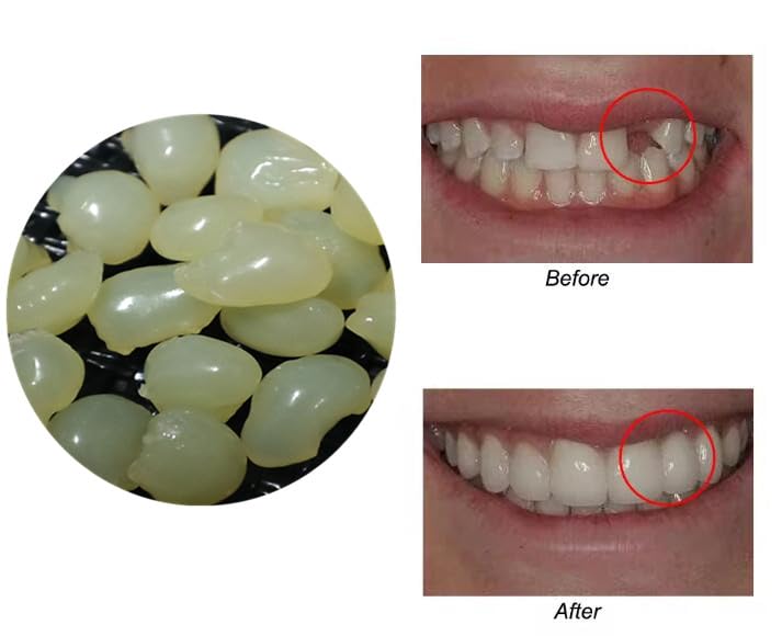 Safe material beads kit for DIY tooth repair and cosplay