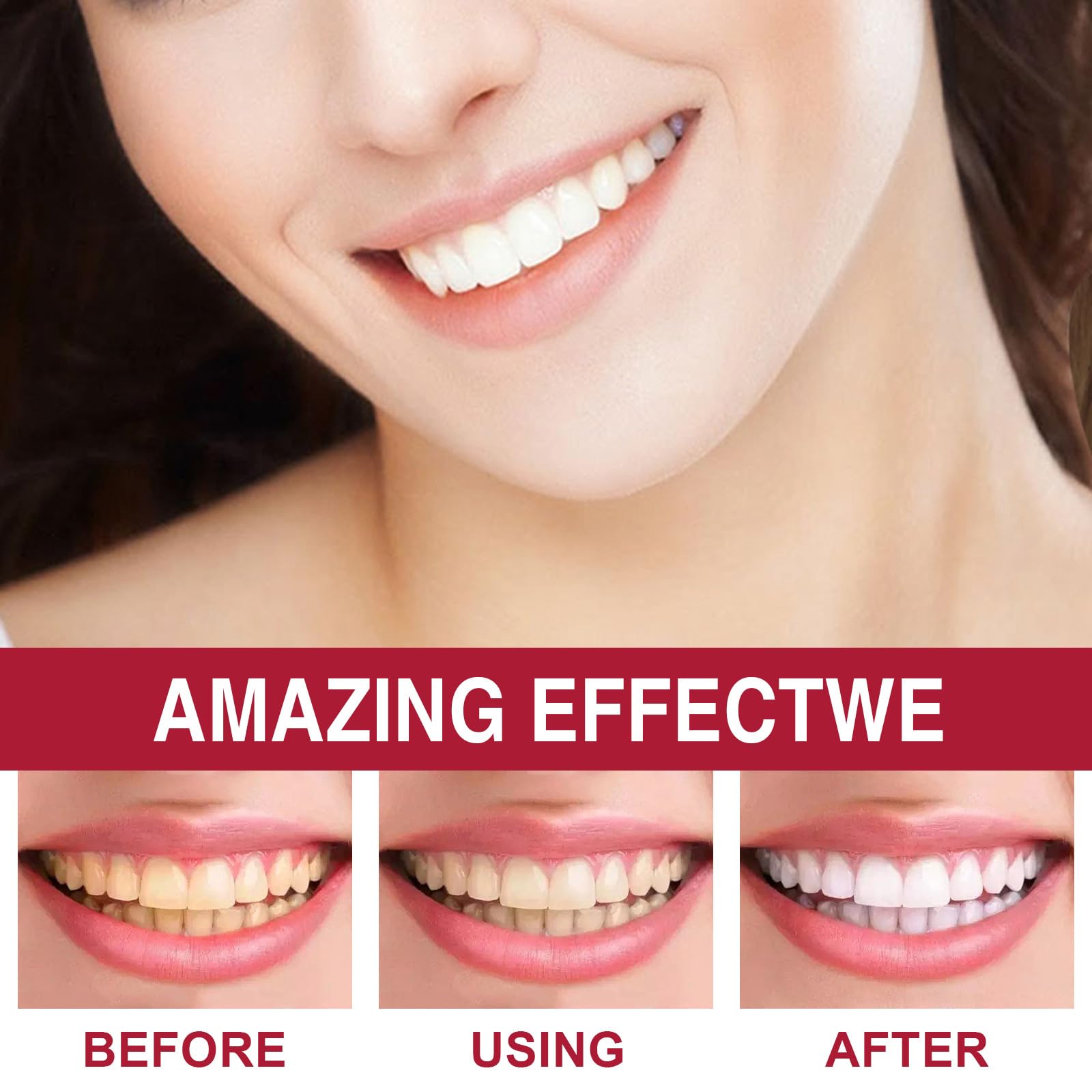 Before and after stain removal showing cleaner teeth