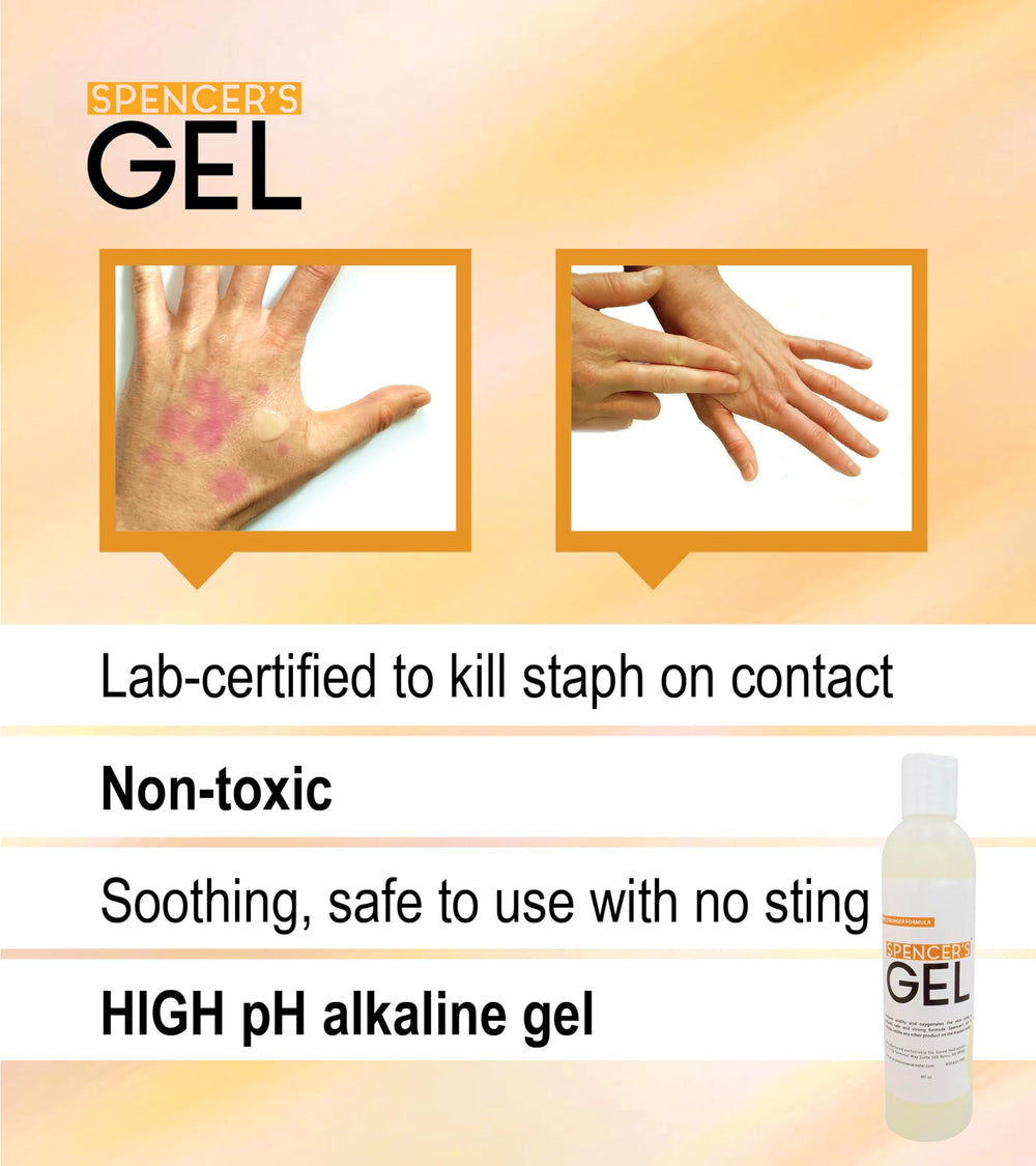 Packaging variation note for Spencer's Gel indicates label differences