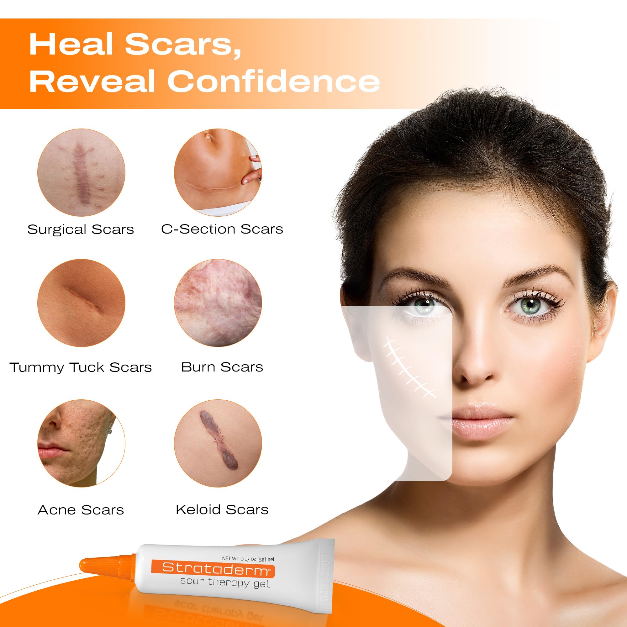 Strataderm Professional Scar Gel on old and new scars shows visible improvement.