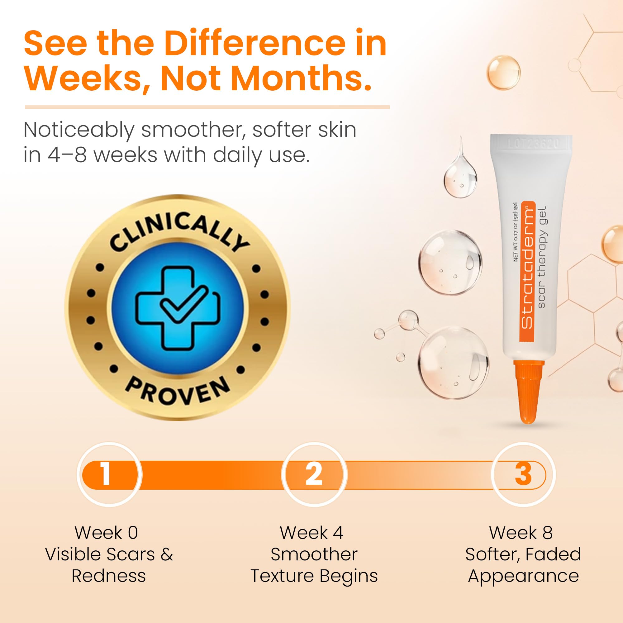 Strataderm Professional Scar Gel timeline image hints at steady scar appearance improvement.