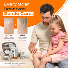 Strataderm Transparent Scar Gel applied for discreet scar care.