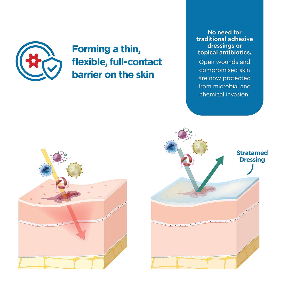Stratamed moist-environment wound image highlights supportive healing conditions.