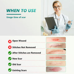 SUCONBE silicone scar tape may help improve texture over time on a scar
