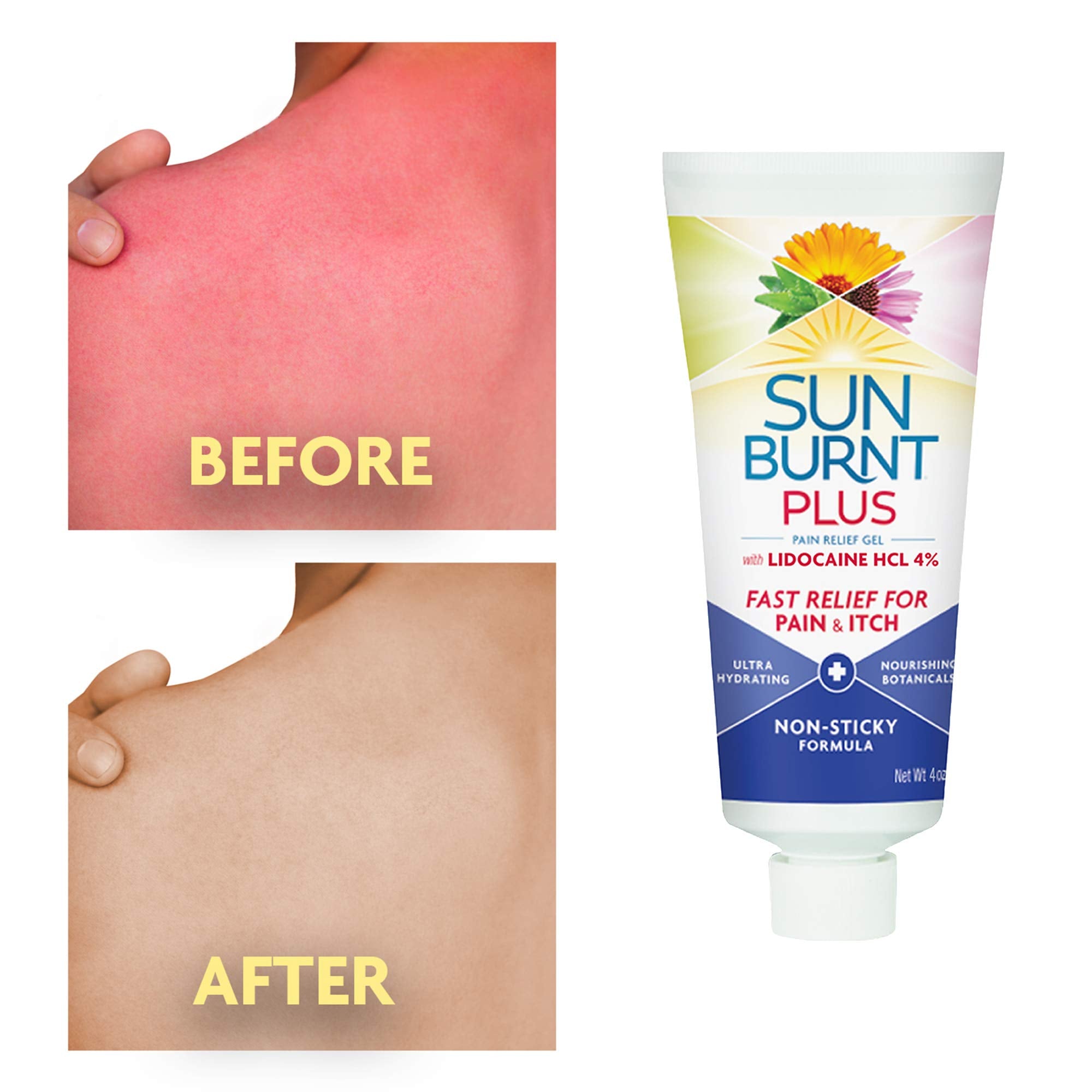 Sunburnt Plus gel label with lidocaine highlights quick comfort for sunburned skin.