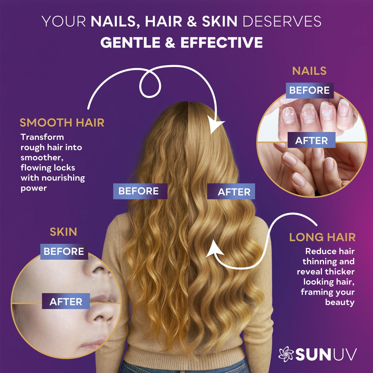 MSM and marine collagen components for hair growth