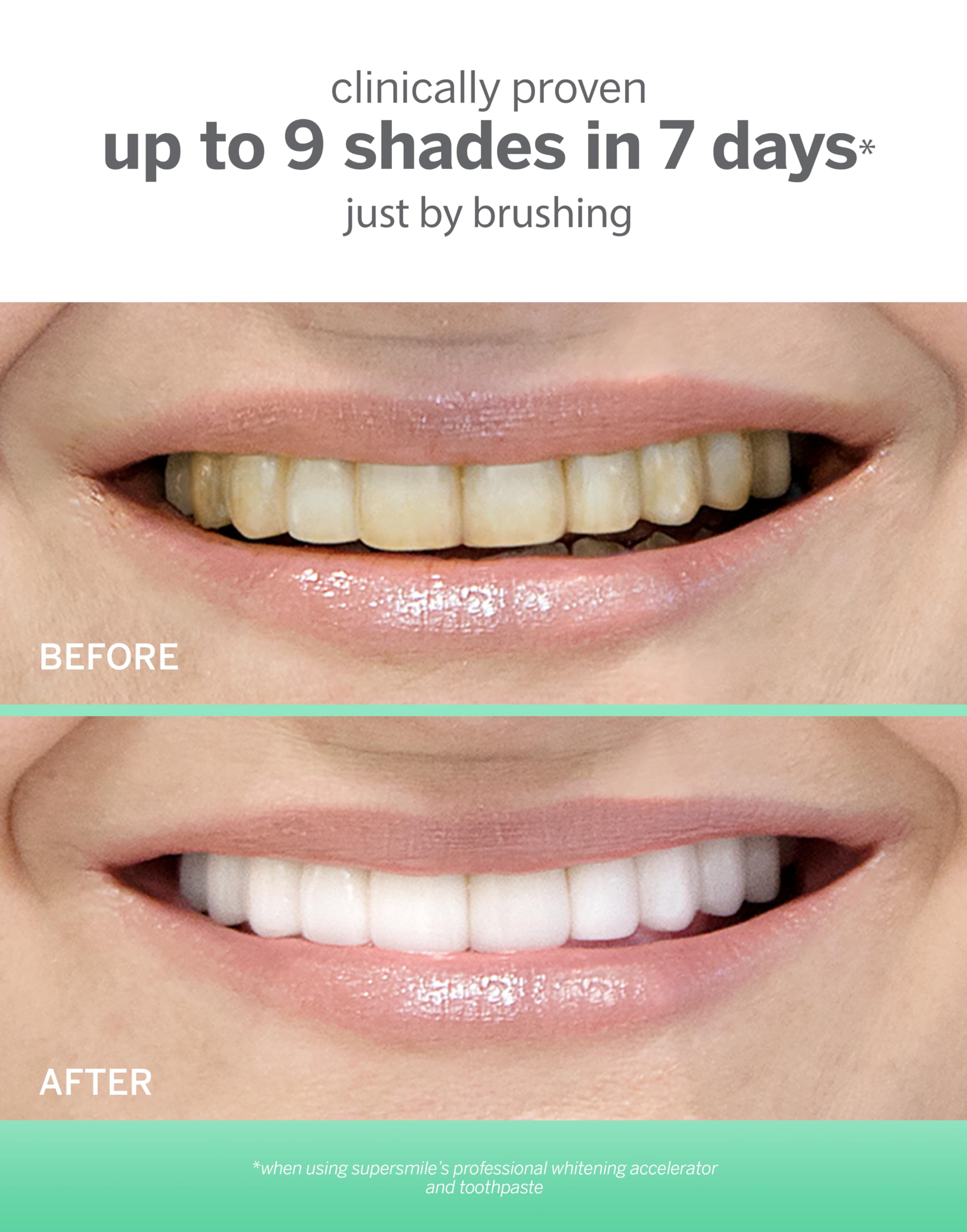 Illustration of Calprox formula used in Supersmile toothpaste