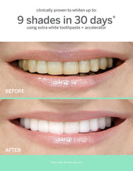 Whitening gel being dispensed from the applicator
