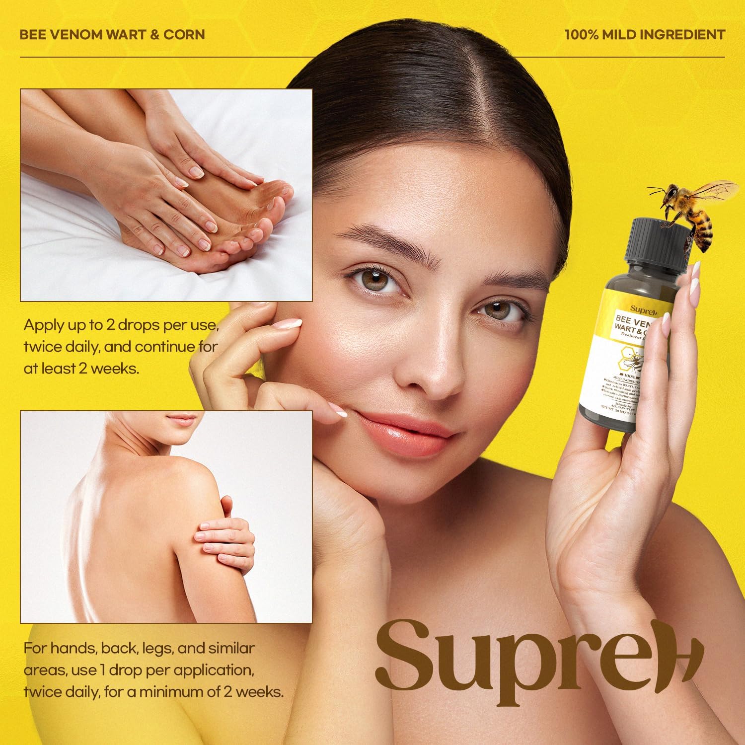 SupreH flat wart close-up shows precise topical action.