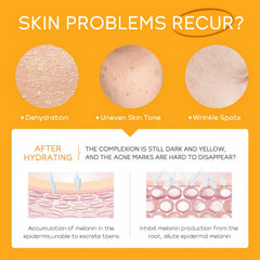 SURORAIN Travel Pouch with the skincare trio for easy trips
