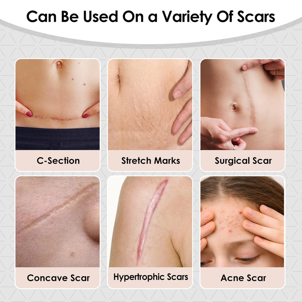 SWturK medical-grade silicone patch highlights gentle, safe scar treatment.