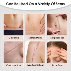SWturK medical-grade silicone patch highlights gentle, safe scar treatment.
