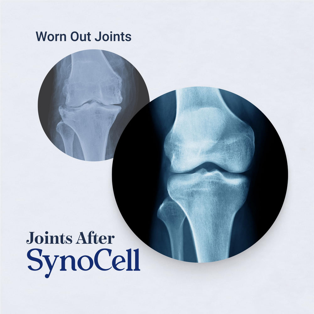 Synocell quercetin detail presents antioxidant-friendly formulation for joints.